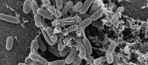 E. coli cells