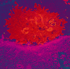 Killer cell (red) attaching to cancer cell (pink).