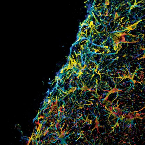 Biomaterials for brain repair - Microscopy Australia