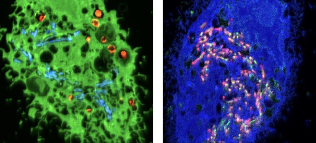 Correlative microscopy for improved TB treatments - Microscopy Australia