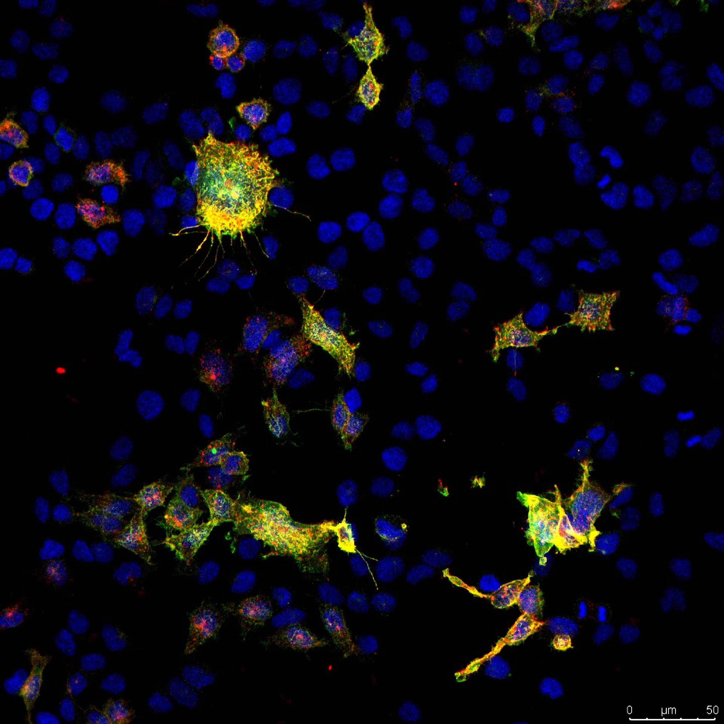 Confocal image from the project showing cultured cells with LCCR15 in yellow and green and the SARS-Cov-2 spike protein in red. Taken by Dr Cesar Moreno at the University of Sydney facility.