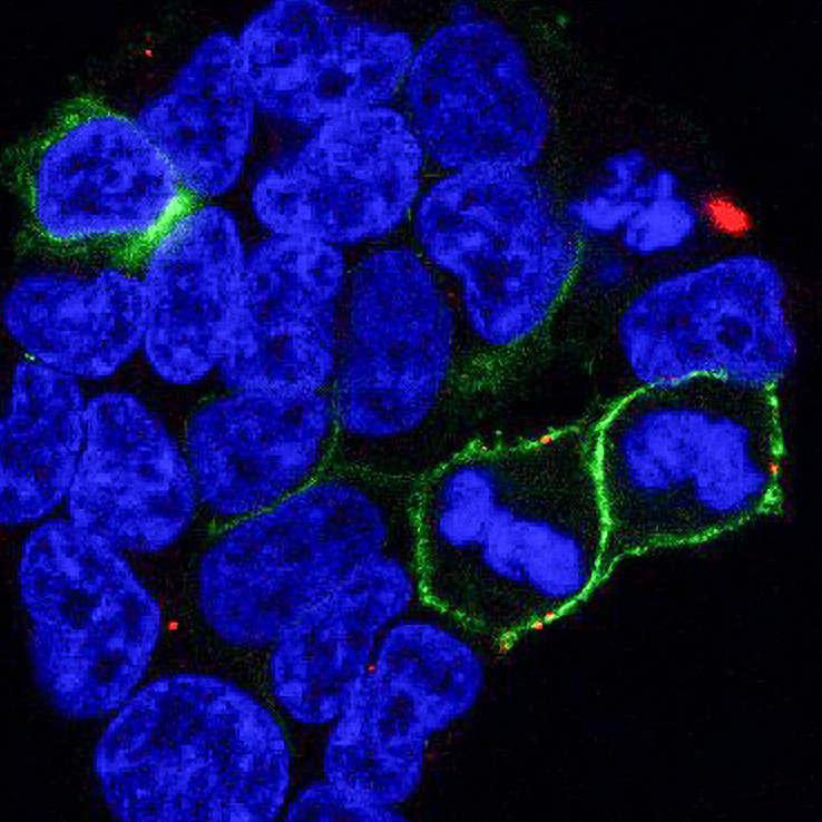 Confocal image of cells from the project showing LCCR15 in green and the SARS-CoV-2 spike protein in red. Taken by Dr Cesar Moreno at the University of Sydney facility.