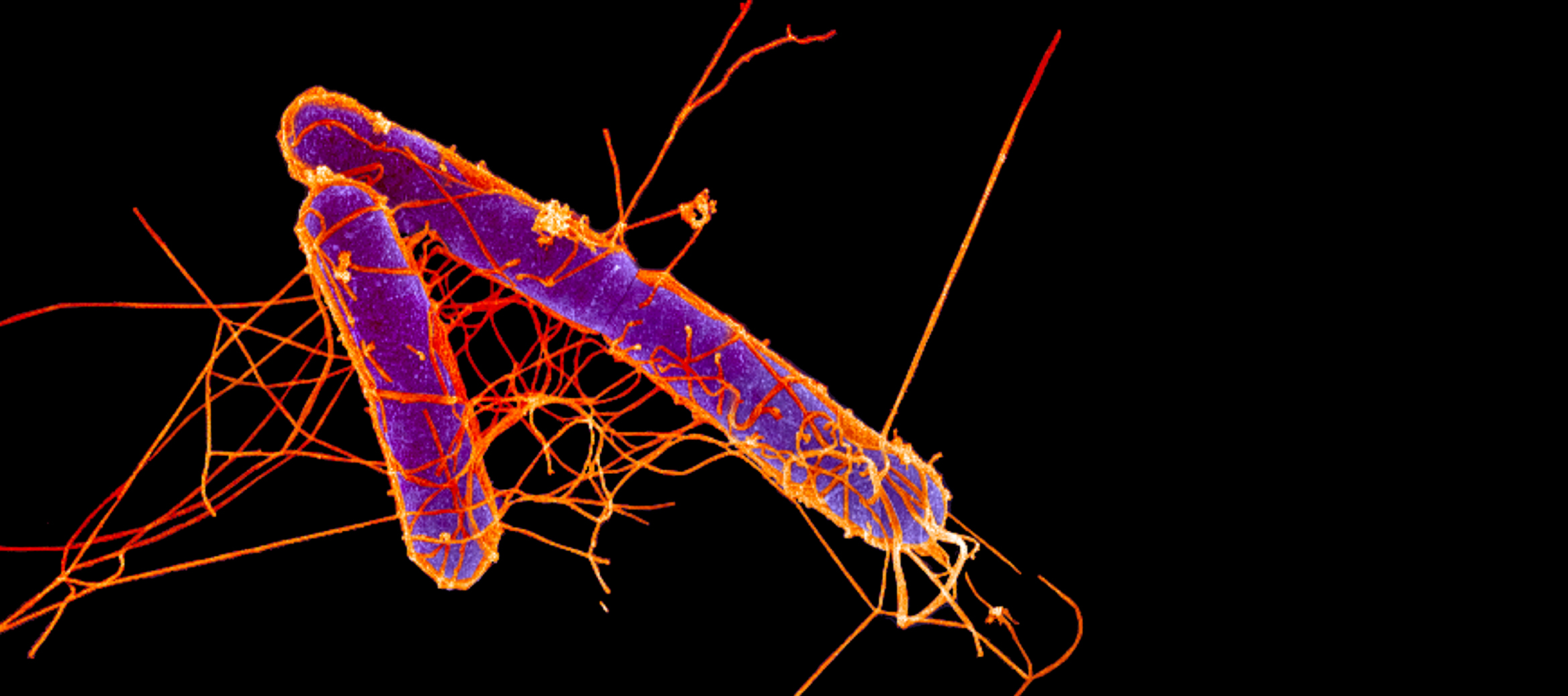 Killer peptides to tackle antibioticresistant bacteria Microscopy