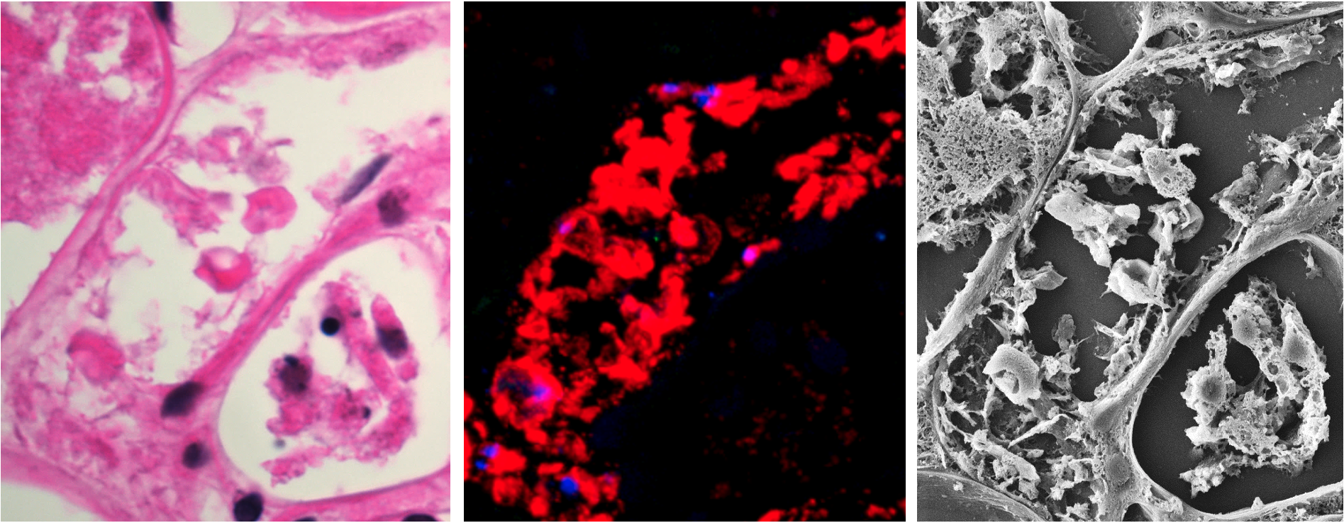 Published in Nature: New clotting mechanism explains serious organ ...